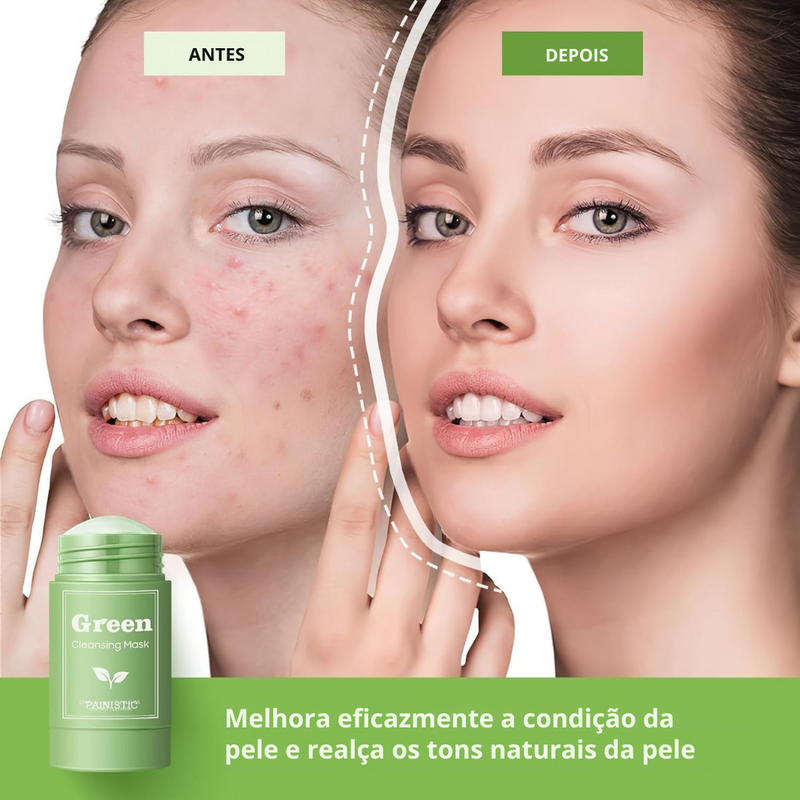 GreenTea Stick — Máscara Facial Removedora de Cravos
