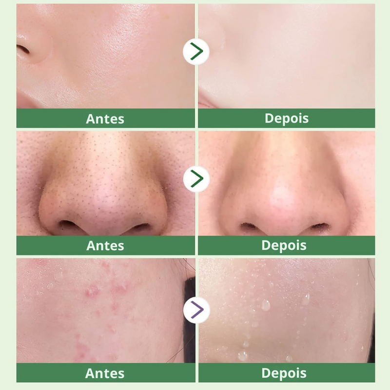 GreenTea Stick — Máscara Facial Removedora de Cravos