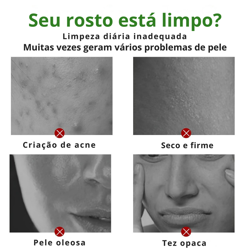 GreenTea Stick — Máscara Facial Removedora de Cravos
