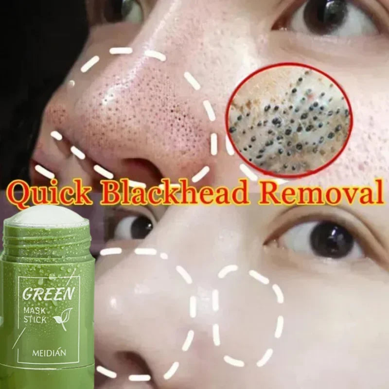 GreenTea Stick — Máscara Facial Removedora de Cravos